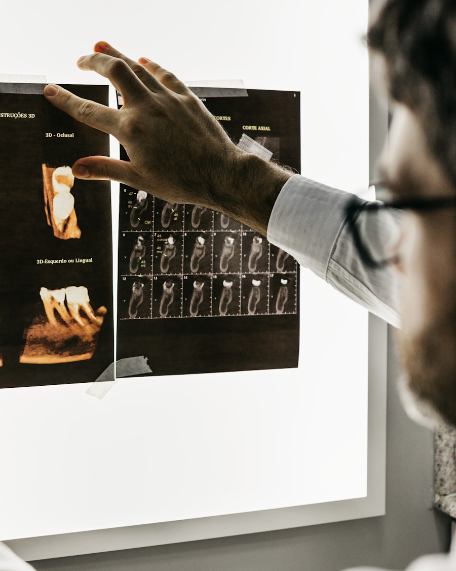 Especialista revisando radiografías 3D para planificación de implantes dentales